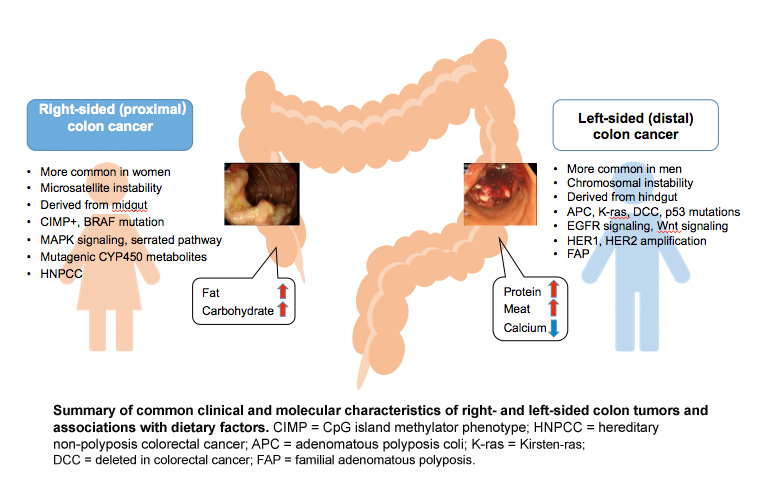 left side right side colon images